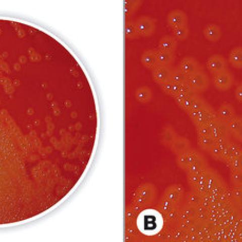 Blood Agar (Base), for microbiology, 500 g, plastic